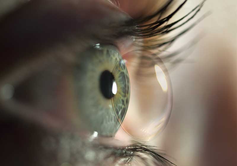 occhio-lente-contatto